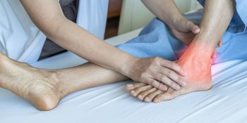 Achilles Tendonitis