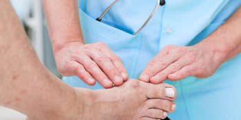 Bunions