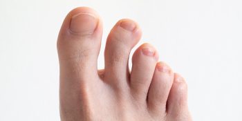 Bent Toes
